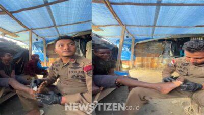 Pelukan Hangat di Bumi Cenderawasih, Satgas Cartenz Rawat Anak Terluka di Sugapa