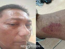 DPD PJS Sumut Desak Polisi Tangkap Pelaku Penganiayaan Wartawan di Toba